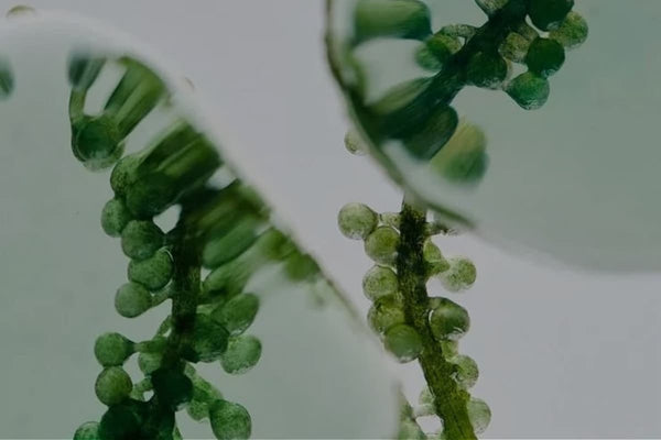 Cómo mejorar la microbiota intestinal