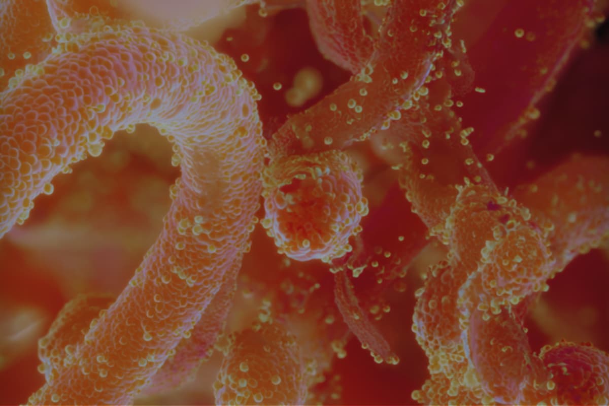 Cómo recuperar la flora intestinal para un bienestar total