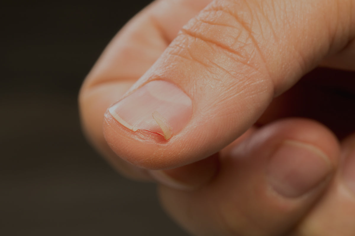 ¿Por qué se rompen las uñas?